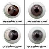 لنز چشم رویال ویژن مدل APRICOT کد 10 رنگ طوسی عسلی طبیعی دوردار