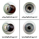 لنز چشم رویال ویژن مدل CAN BL کد 27 رنگ آبی طبیعی دور دار