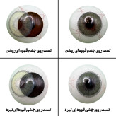لنز چشم رویال ویژن مدل DAZZLING GR کد 38 رنگ سبز طبیعی دوردار