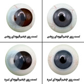 لنز چشم رویال ویژن مدل PIXY BL کد 40 رنگ آبی عروسکی