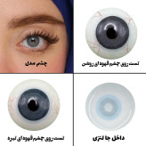 لنز چشم رویال ویژن مدل PIXY BL کد 40 رنگ آبی عروسکی