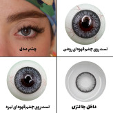 لنز چشم هرا مدل 05 کد HV210 رنگ طوسی آبی دوردار
