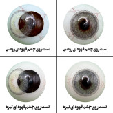 لنز چشم هرا مدل 09 کد RYA310 رنگ طوسی سبز دور دار