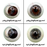 لنز چشم هرا مدل 10 کد HJ310 رنگ طوسی آبی مرکز عسلی دور دار