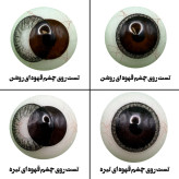 لنز چشم هرا مدل 30 سالانه کد S02 رنگ مشکی